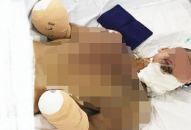 Tin thêm về vụ nổ nghi do tự chế pháo tại xã Kỳ Sơn (Thủy Nguyên)