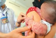 Chuyện thời cuộc: Hậu quả khôn lường!