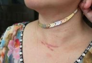 Giết cụ bà, cướp dây chuyền vàng để đóng quỹ người cao tuổi