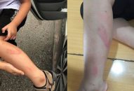 Làm bài kiểm tra học kỳ chậm, học sinh lớp 2 bị cô giáo tát vào thái dương, đánh tím chân