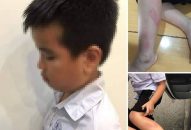 Vụ cô giáo đánh học sinh vì làm bài chậm: Đình chỉ dạy 6 tháng