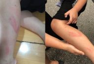 Xử lý nghiêm vụ phạt đánh học sinh tại Trường Tiểu học Quán Toan