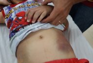 Cha mẹ đẻ bạo hành con cái: Phản giáo dục, trái đạo đức xã hội