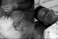 Đang hát karaoke bị trai làng xông vào đánh trọng thương