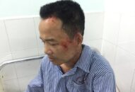 Người dân tố bị côn đồ hành hung sau khi xô xát với giám đốc doanh nghiệp