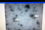 Dự kiến cuối tuần tới sẽ có bộ kit xét nghiệm virus Corona ‘made in Việt Nam’