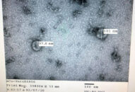 Việt Nam nuôi cấy và phân lập thành công virus Corona mới