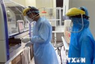 Hướng dẫn việc xét nghiệm COVID-19 tại các cơ sở có phòng xét nghiệm