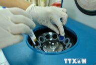 Báo động tình trạng người Việt Nam thừa cholesterol ở mức cao