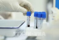 Bộ Y tế hướng dẫn áp dụng mức giá xét nghiệm COVID-19 cho người xuất cảnh