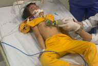 Hải Phòng: Lầm tưởng kẹo, bé trai 6 tuổi ăn phải thuốc diệt chuột