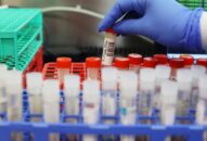 Anh phát hiện biến thể SARS-CoV-2 mới có khả năng kháng miễn dịch đáng lo ngại