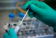 BN5463 tại TP.HCM tử vong do COVID-19 nặng trên cơ địa suy thận mạn giai đoạn cuối