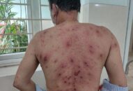 Cảnh báo mối nguy hiểm khi dùng thuốc nam để chữa bệnh