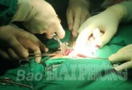 Trung tâm Y tế quân dân y Bạch Long Vĩ cấp cứu kịp thời ngư dân bị viêm ruột thừa cấp