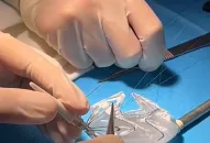 Vinmec áp dụng công nghệ 3D hỗ trợ can thiệp tim mạch lần đầu tiên ở Đông Nam Á