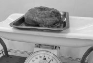 Bệnh viện Phụ sản Hải Phòng: Hướng dẫn từ xa Bệnh viện Sản nhi Lào Cai cắt bỏ khối u buồng trứng nặng 2kg và ruột thừa viêm cấp