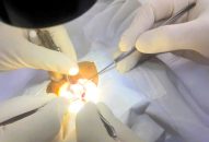 Tai nạn sinh hoạt nghiêm trọng: Bệnh nhân được cấp cứu kịp thời tại Khoa Mắt Trẻ em, Bệnh viện Mắt Hải Phòng