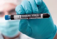 Chủ động giám sát, phát hiện và kiểm soát bệnh do virus Marburg