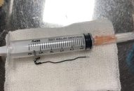 Bệnh viện Trẻ em Hải Phòng cấp cứu kịp thời bé trai 25 tháng tuổi nuốt phải kim băng sắc nhọn