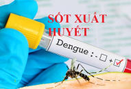 Đẩy mạnh các biện pháp tăng cường phòng chống Sốt xuất huyết Dengue